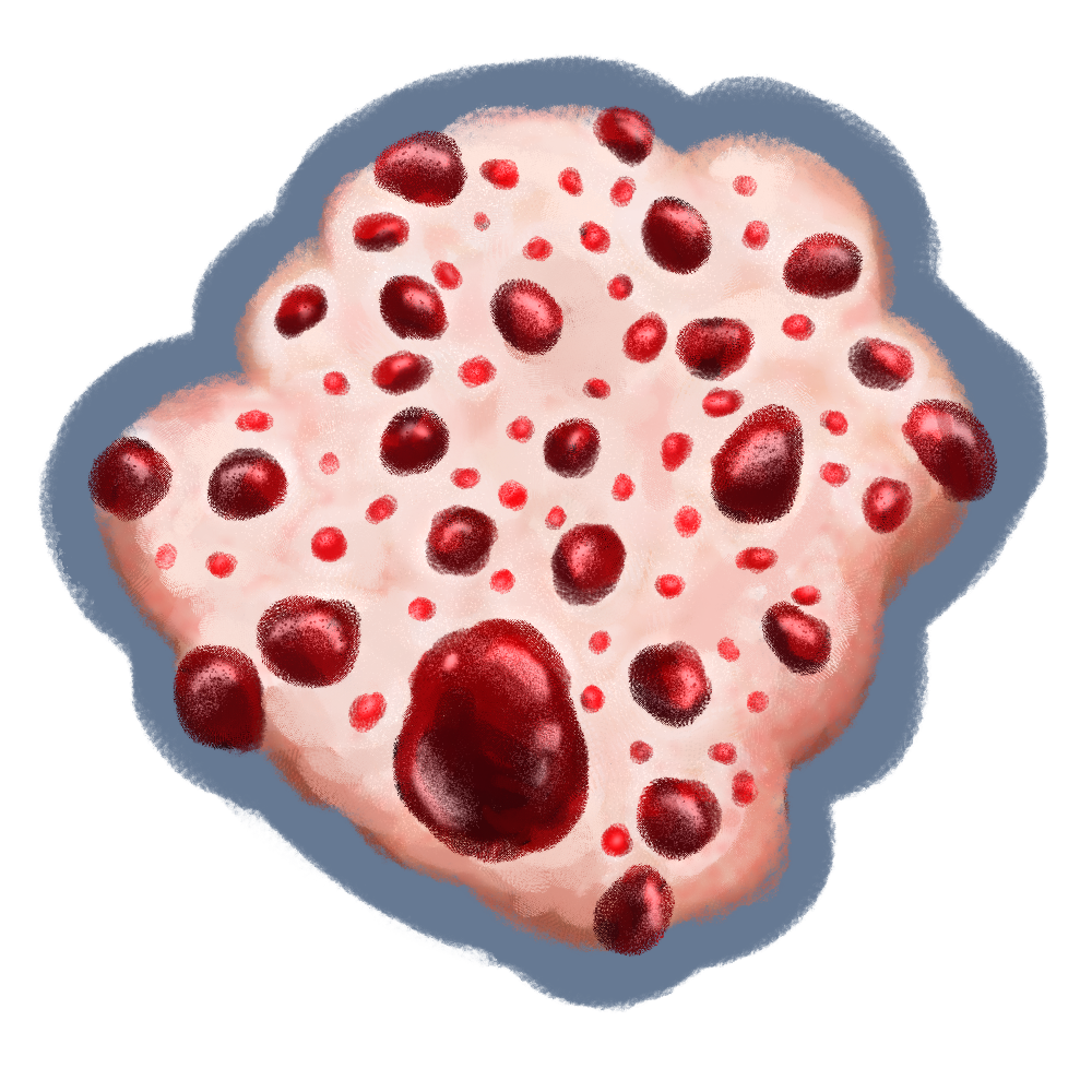Hydnellum peckii